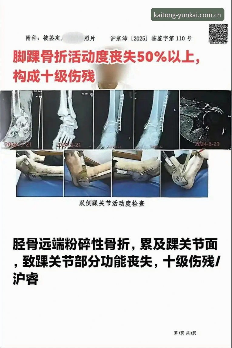 施洛特贝克左脚踝韧带撕裂确认伤缺8周，云开全站平台同步呈现世界杯伤情最新动态
